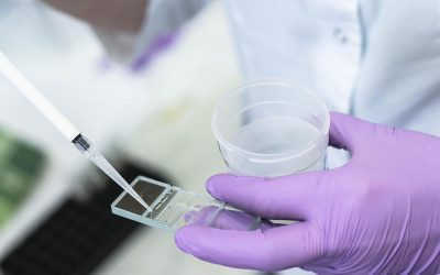 Xét Nghiệm Tinh Dịch Đồ Hết Bao Nhiêu Tiền? Ở Đâu Hà Nội?