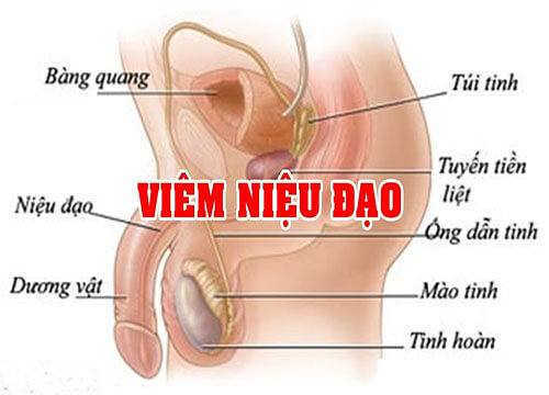 Bệnh lý vùng niệu đạo