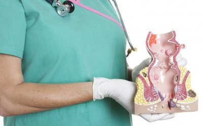 Báo động tỷ lệ người mắc bệnh trĩ ngày càng tăng