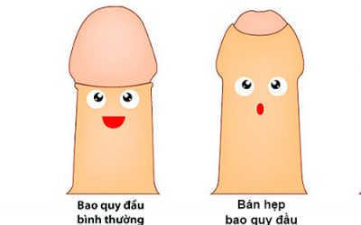 [Cảnh báo] Bán hẹp bao quy đầu nguy hiểm như thế nào?