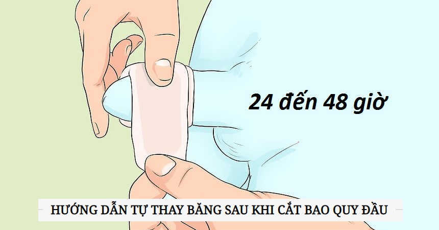 Cắt bao quy đầu bao lâu thì tháo băng?