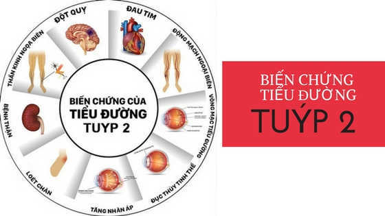 Mướp đắng tốt cho người mắc bệnh tiểu đường typ II: 