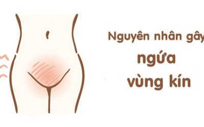 Nguyên nhân vùng kín ngứa rát và cách chữa tại nhà
