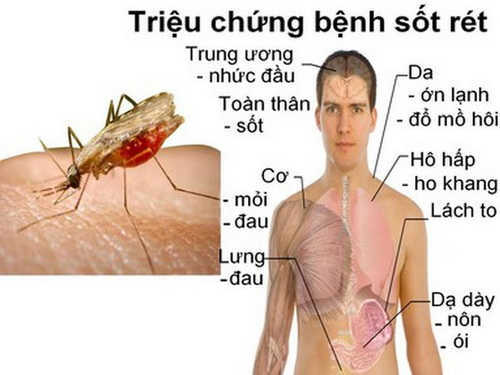 Cải thiện tình trạng sốt rét