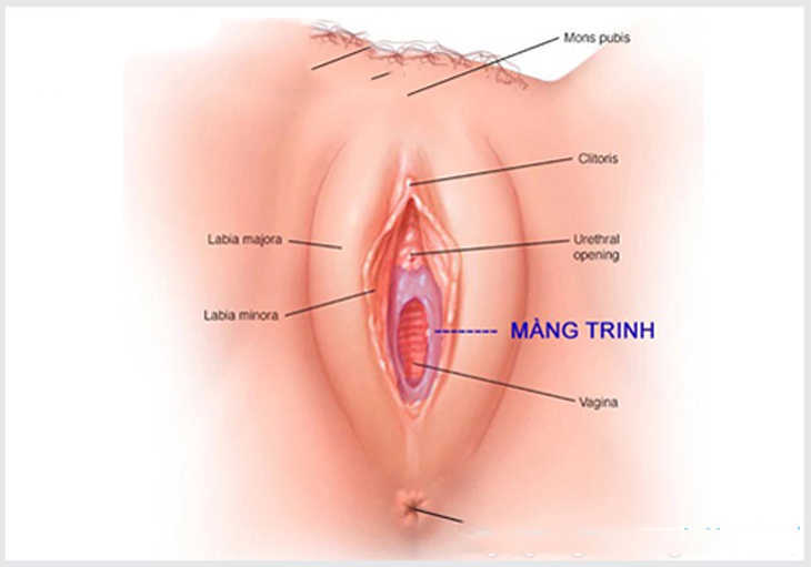 Do bị bệnh polyp khiến