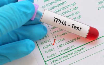 [ BÁC SĨ GIẢI ĐÁP ] Xét nghiệm TPHA là gì? Quy trình và bảng giá