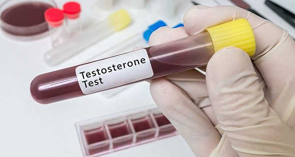 Do nồng độ testosterone thấp