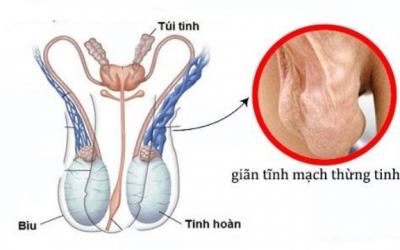 Tinh hoàn nhỏ có ảnh hưởng gì không & cách cải thiện kích thước tinh hoàn