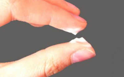 Khí Hư Có Mùi Chua Là Bệnh Gì & Cách Chữa Hiệu Quả