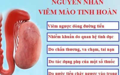 Dấu hiệu viêm mào tinh hoàn có dễ nhận biết không?