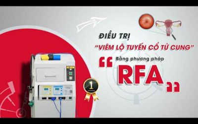 Chi phí chữa viêm lộ tuyến bằng RFA bao nhiêu là hợp lý?