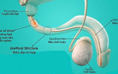 Uống bia đi tiểu nhiều có phải thận yếu? Câu trả lời TẠI ĐÂY
