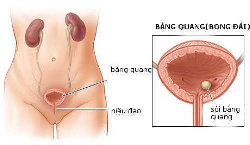 Rối loạn chức năng ở bàng quang