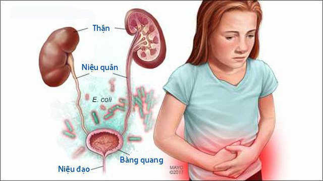 Triệu chứng nhận biết khi mắc bệnh ở bàng quang