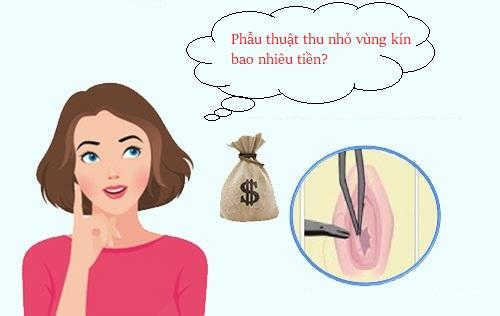 Phẫu thuật se khít vùng kín bao nhiêu tiền?