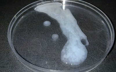 Giải đáp thắc mắc: Tinh trùng vón cục có con được không?