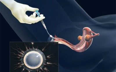 Giải đáp thắc mắc: Bơm tinh trùng vào tử cung bao lâu thì gặp trứng??