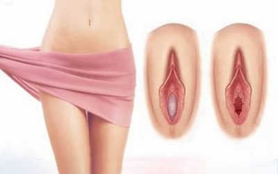 Vá màng trinh Hà Nội bao tiền [4 địa chỉ vá màng trinh uy tín]