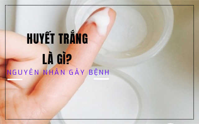 Huyết trắng và những nguyên nhân gây bệnh