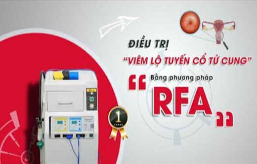 Kỹ thuật sóng cao tần RFA